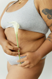 Stretch Marks: Oorzaken, Symptomen, Behandeling en Preventie